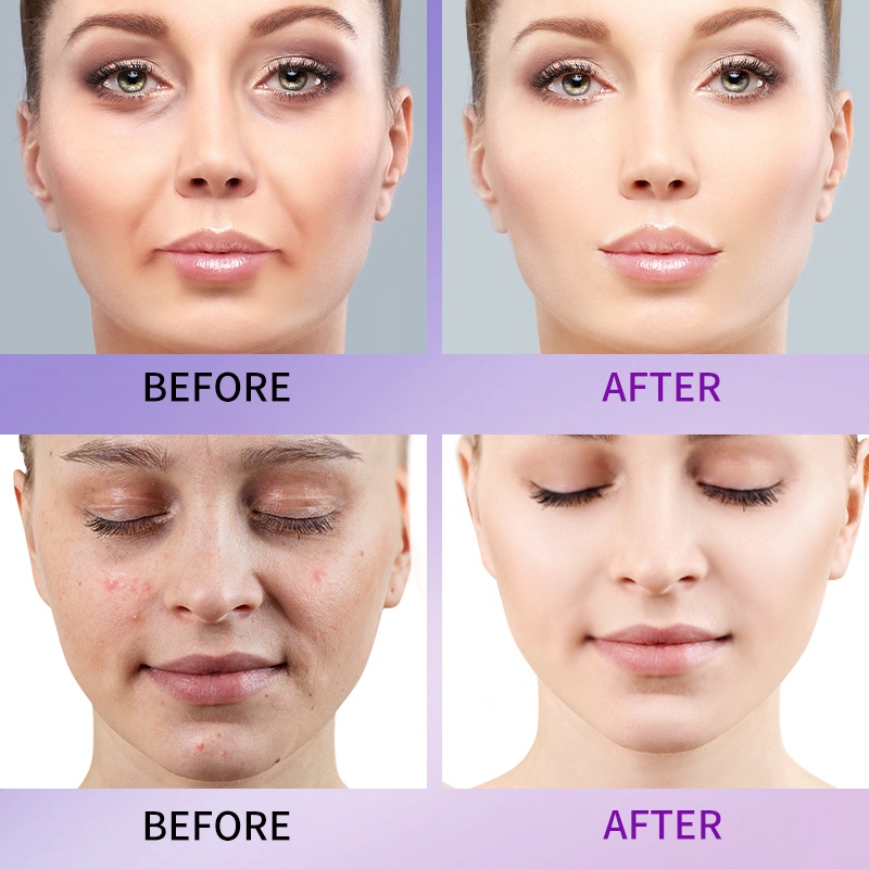 فيتامين C والريتينول A مصل الوجه المضاد للشيخوخة في النهار والليل (5)