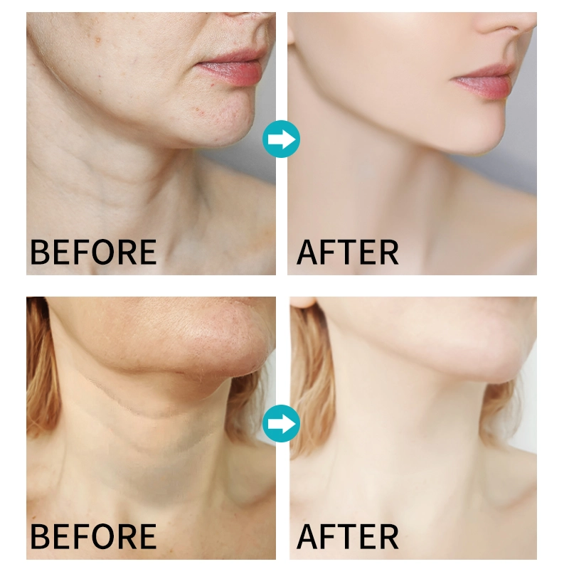 DRL-1731-Vitamin c ultra-smoothing neck cream-Main (2)