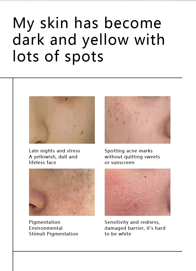 Whitening fade spots mask | DR.RASHEL